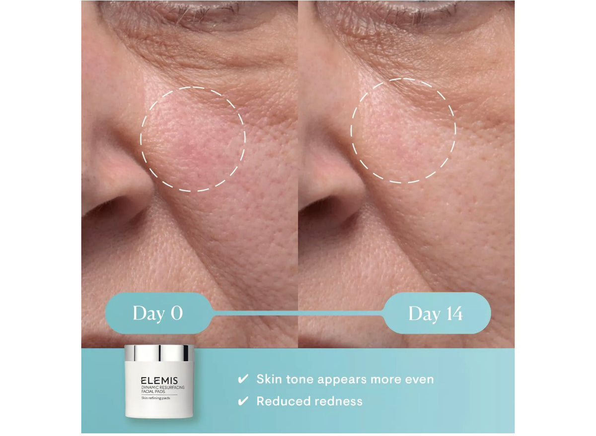 ELEMIS Dynamic Resurfacing Facial Pads Skin Smoothing Pads 14pads