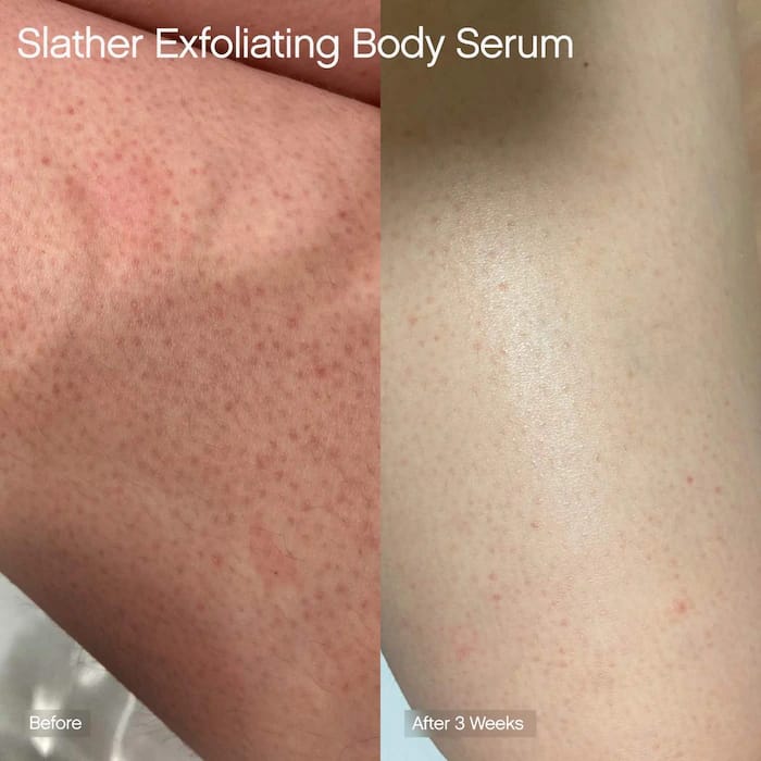 Topicals Slather Exfoliating Body Serum with Retinol and AHAs 50ml